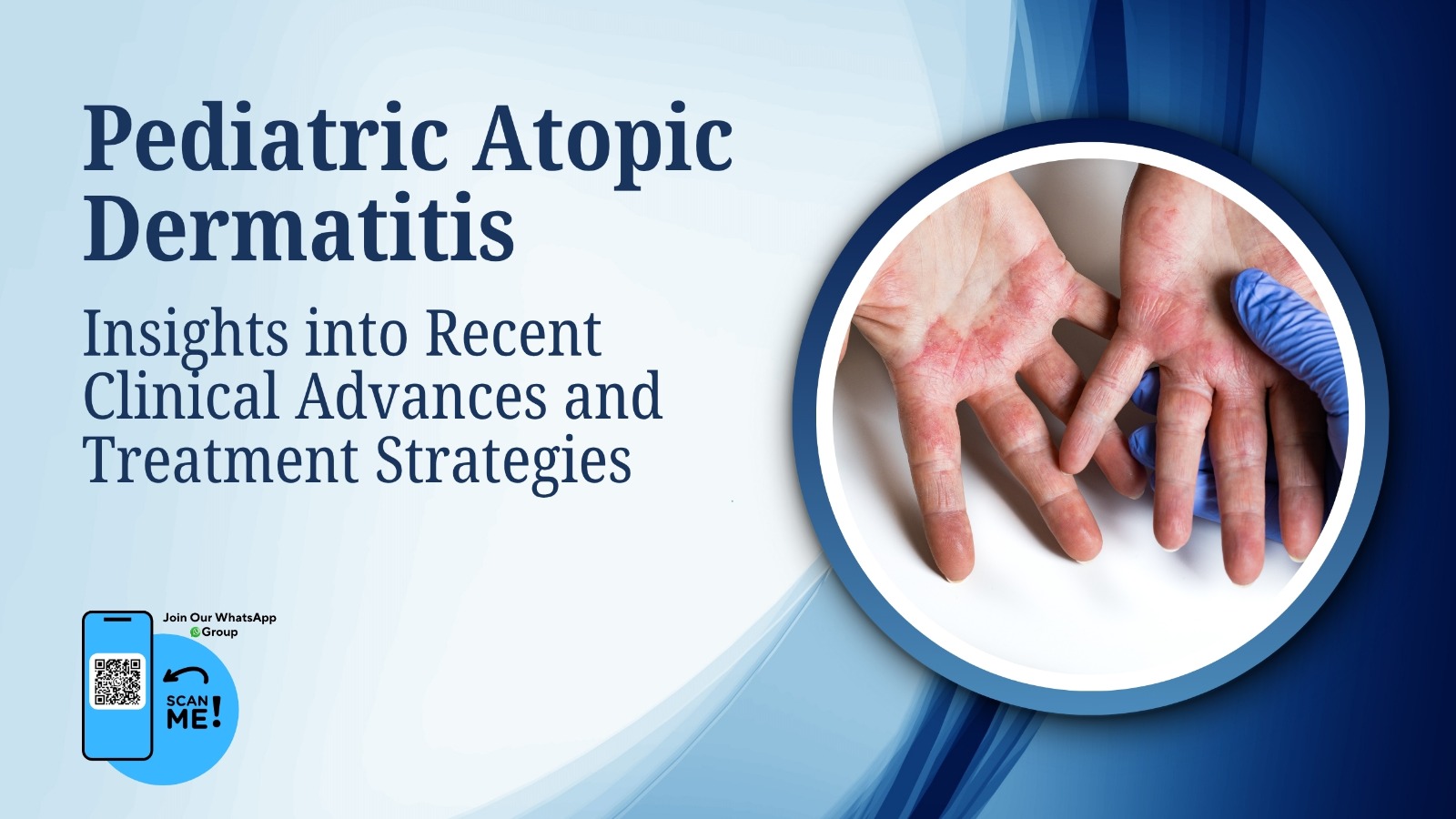 Pediatric Atopic Dermatitis: Insights into Recent Clinical Advances and Treatment Strategies